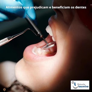 Alimentos: como influenciam a saúde bucal no Centro do Rio