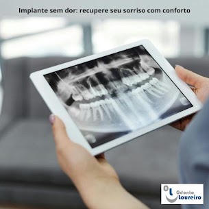 Implante sem dor: recupere seu sorriso com conforto e tecnologia no centro do Rio