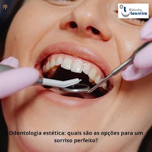 Odontologia estética no Centro do Rio: descubra como conquistar o sorriso dos seus sonhos