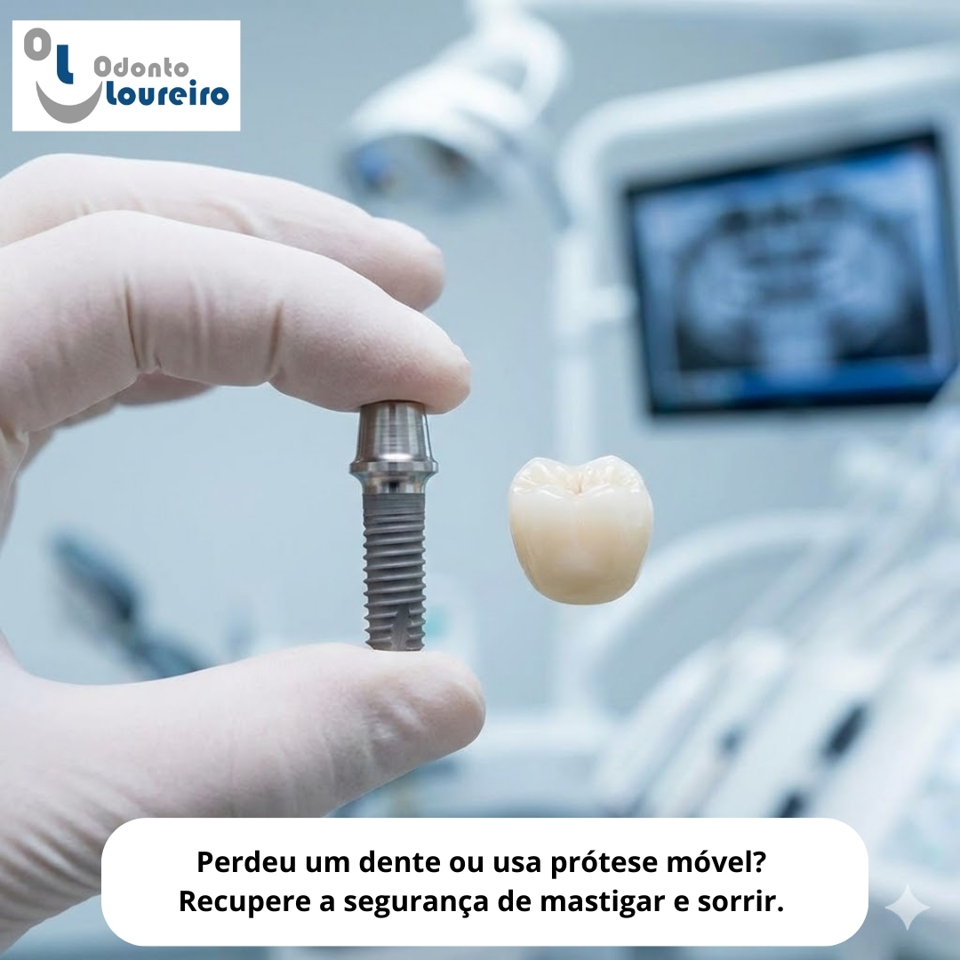 Perdeu um Dente ou Usa Prótese Móvel? Recupere a Segurança de Sorrir e Mastigar no Centro do RJ